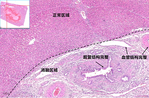 Porcine Liver Ablation Pathology Images