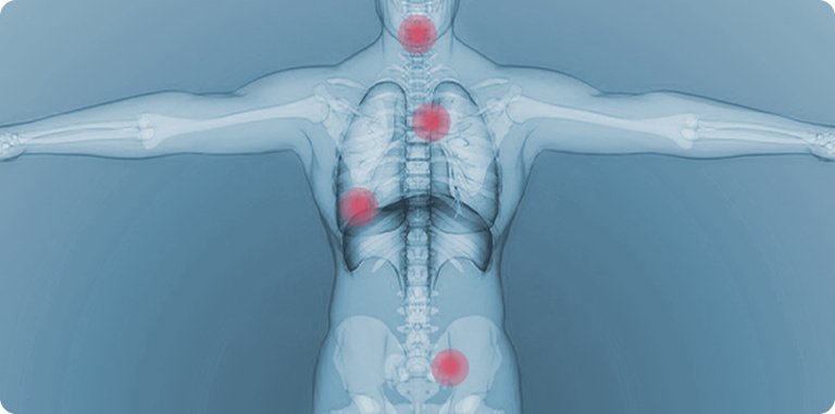 Broad applicability, breaking through traditional limitations