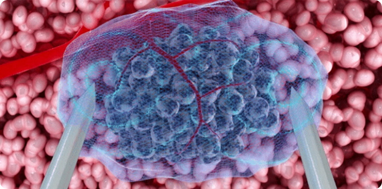 Expand Range, Enhance Efficiency