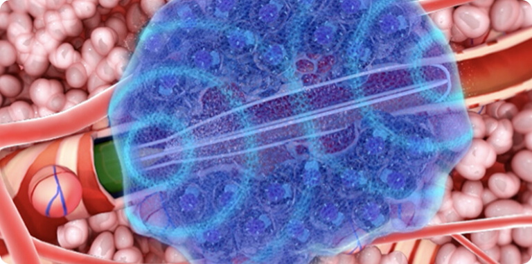 Eliminate lesions, minimize damage.